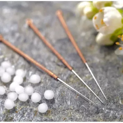 Acupuncturist ㊗️ Stress/Pain/Emotions/Acudetox